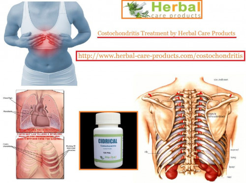 11-Natural-Remedies-for-Costochondritis.jpg