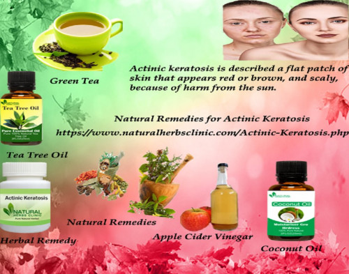 There are many people who have claimed and recorded that when they used different Natural Remedies for Actinic Keratosis, and with a passage of time, it was healed completely.... https://naturalherbsclinic.mystrikingly.com/blog/natural-remedies-for-actinic-keratosis