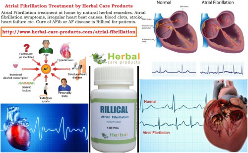 The Herbal Treatment for Atrial Fibrillation is intended at reducing or normalizing the heart rate, preventing recurrence and preventing complications like stroke and heart failure. Natural Treatment for Atrial Fibrillation usually depends on the types of symptoms their severity and the present heart-related conditions.
https://herbalcareproductstreatment.wordpress.com/2018/10/10/9-natural-herbal-treatment-for-atrial-fibrillation/