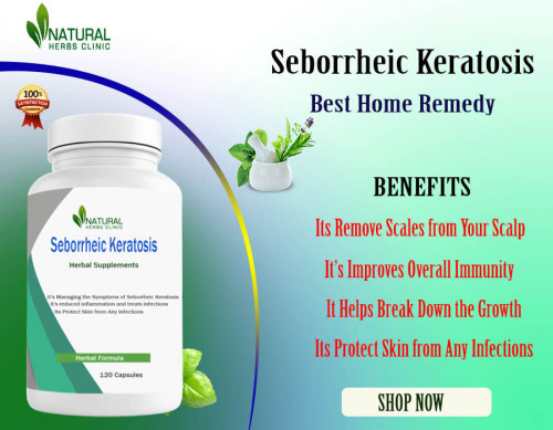 If you have this skin condition, it has been demonstrated that using Home Remedies for Seborrheic Keratosis such as apple cider vinegar and tea tree oil can help with the discomfort and appearance of the condition. https://www.herbal-care-products.com/blog/affected-with-seborrheic-keratosis-read-about-home-remedies-benefits/