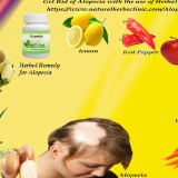 Alopecia-Natural-Treatment