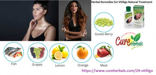 Benefits-of-Vitiligo-Natural-Recovery-Options-or-Herbal-Remedies.png