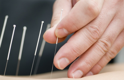 Best-Acupuncture-Clinic-In-Delhi-Ncr.jpg