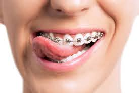 Best-Orthodontist-in-Bhopal.jpg