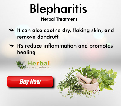 Blepharitis80960a6c5f8f5e7c.jpg