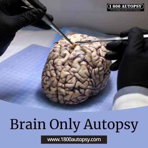 Brain-Only-Autopsy_02.jpg