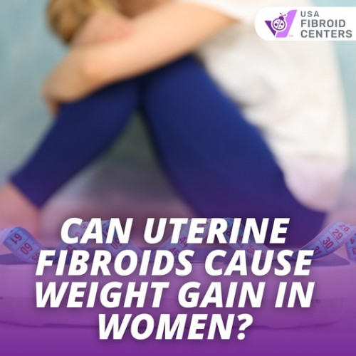 CAn-Uterine-Fibroid-Causes-Weight-gain.jpg