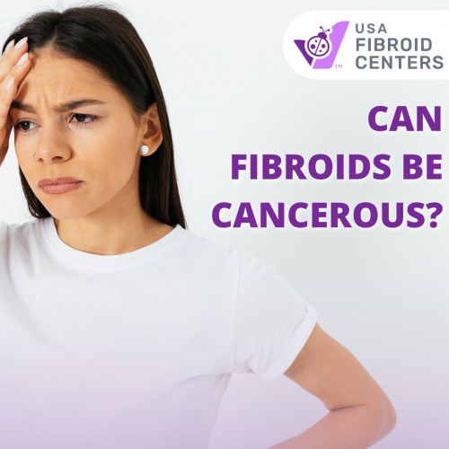 Can-Fibroid-Be-Cancerous.jpg