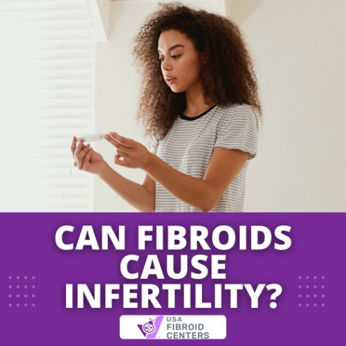 Can-Fibroid-cause-Infertility.jpg