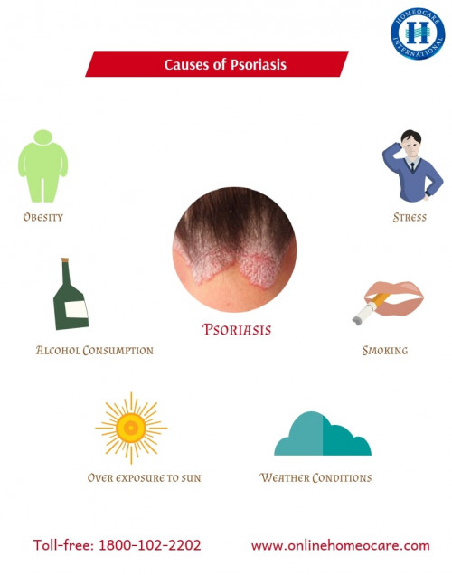 Causes of Psoriasis