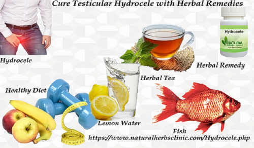 The Natural Remedies for Hydrocele that we offer is effective, fast; durable and above all, it will prevent you from going through an operation. It is a miracle solution to cure testicular hydrocele... http://naturalherbsclinic.over-blog.com/2021/01/cure-testicular-hydrocele-with-herbs.html