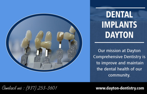 Dental-Implants-Dayton.jpg