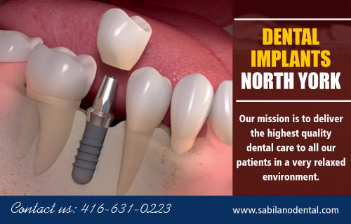 Dental-Implants-North-York.jpg