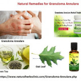 Effective-Article-for-Patients-to-Know-About-Granuloma-Annulare-Disease3056c3a7fd4c7eab