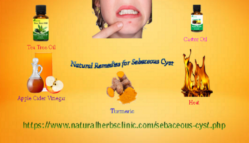 There is a lot of Natural Remedies for Sebaceous Cyst that use turmeric. This healing spice assists to cleanse the blood... https://www.natural-health-news.com/natural-remedies-for-sebaceous-cyst/