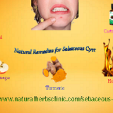 Get-Rid-of-Sebaceous-Cyst-with-the-Use-of-5-Natural-Remedies