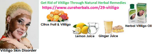 Get-Rid-of-Vitiligo-Through-Natural-Herbal-Remedies.png