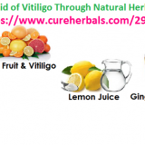 Get-Rid-of-Vitiligo-Through-Natural-Herbal-Remedies