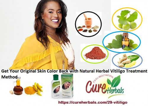 Get-Your-Original-Skin-Color-Back-with-Natural-Herbal-Vitiligo-Treatment-Method.jpg