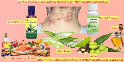 Use leaves of neem in Natural Remedies for Hidradenitis Suppurativa. Grind a handful of neem leaves into a paste.... https://www.natural-health-news.com/natural-remedies-for-hidradenitis-suppurativa/