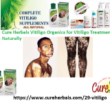 Herbal-Vitiligo-Organics