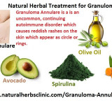 HerbalTreatment-for-Granuloma-Annulare