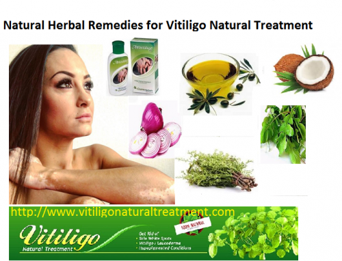 The just trustable treatment is Vitiligo Natural Treatment. This treatment involves the treatment throughout herbs. Herbal remedies are the most precise treatments options. Anti vitiligo herbal oil is that formula that ensures 100% revitalization from the skin disease... https://vitiligonaturaltreatment.myfreesites.net/vitiligo-natural/here-we-describes-the-vitiligo-skin-disorder-and-its-treatment-with-natural-herbal-ways