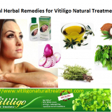 Here-We-Describes-the-Vitiligo-Skin-Disorder-and-its-Treatment-with-Natural-Herbal-Ways