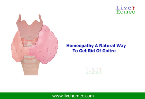 Homeopathy-Clinics-for-Goitre-In-HSR-layout.jpg