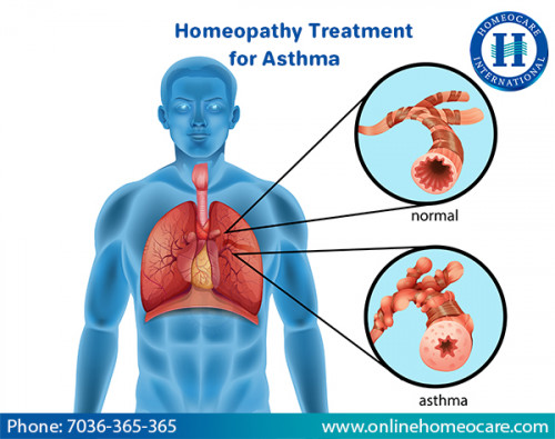 Homeopathy-Treatment-For-Asthma.jpg