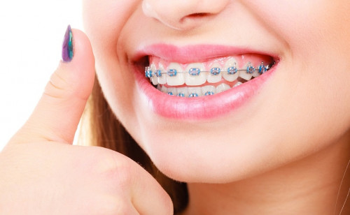 Dr. Ohanian is an Ivy-league trained Pasadena Orthodontist offering Invisalign & braces. Providing orthodontic care for Arcadia, South Pasadena, Alta Dena, & Glendale.

Please Visit Our Website  https://goorthopasadena.com/