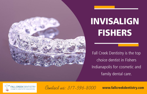 "Invisalign in Fishers give you a smile you've always dreamed of at https://www.fallcreekdentistry.com/about-us

Find us:

https://goo.gl/maps/rbti88JzNpo

The Invisalign system gets results by utilizing clear aligners to shift your teeth with controlled force, similar to the way that standard metal orthodontic appliances do. There are numerous sets of aligners used for each step of treatment to move your teeth into the correct position. There are various added benefits of the Invisalign in Fisher's system.

Our Services:

dentist Fishers
cosmetic dentist Fishers
Veneers Fishers
Invisalign Fishers
Teeth whitening Fishers
Dentist near me Fishers
family dentist Fishers

Address:
10106 Brooks School Rd #500, 
Fishers, Indiana, 46037, United States

Hours of Operation: 

Mon - 8am -5.00pm 
Tues - 7am -3.00pm 
Wed  - 9am -6.00pm
Thurs  - 8am- 4.00pm 
Fri  - 8am-12.00pm 
Sat & Sun- Closed

Call us : 317 596 8000 
E-Mail  : angelagreenaway@yahoo.com

Connect with us :

https://www.facebook.com/Fall-Creek-Dentistry-2245278765789321
https://www.flickr.com/photos/dentistfishers/
https://www.yelp.com/biz/fall-creek-dentistry-fishers
https://twitter.com/InvisalignF
https://www.pinterest.com/dentalindiaa/
https://www.youtube.com/channel/UCpM9bcaltkbyubXgPRB93Aw

Also Visit us:

https://familydentistfishers.tumblr.com/
https://www.slideshare.net/familydentistfishers
https://soundcloud.com/dentistfishers
http://s1347.photobucket.com/user/veneersfishers/profile/
"