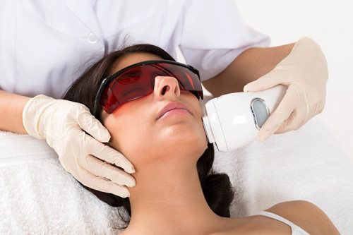 Laser Hair Removal Treatment