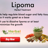 Lipoma