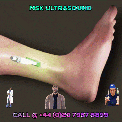 Get the Mentorship in MSK Ultrasound Course by SMUG. Give a call @ +44 (0)20 7987 8899. Visit www.ultrasoundtraining.co.uk