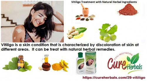 Natural-Herbal-Method-for-Vitiligo-Natural-Treatment.jpg