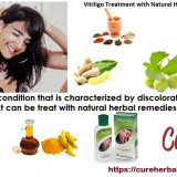 Natural-Herbal-Method-for-Vitiligo-Natural-Treatment