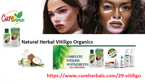 Natural-HerbalVitiligo-Organics.png