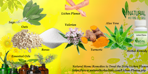 Borax is used in Natural Remedies for Lichen Planus as a palliative to soothe mouth ulcers. It is extremely helpful in controlling itching... https://www.natural-health-news.com/natural-remedies-for-lichen-planus/