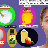 Natural-Remedies-for-Acne1edd4193475a29d4