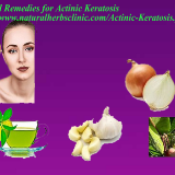 Natural-Remedies-for-Actinic-Keratosis