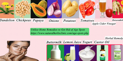 Natural-Remedies-for-Age-Spots.png