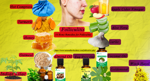 Indian lilac, also commonly known as neem, is one of the best Natural Remedies for Folliculitis. thanks to its excellent anti-inflammatory properties which will bring relief to irritation... https://herbsnaturalclinic.wordpress.com/2021/01/25/natural-remedies-for-folliculitis/