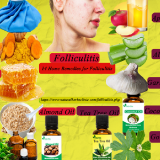 Natural-Remedies-for-Folliculitis