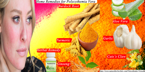 Garlic is a dominant component for Natural Remedies for Polycythemia Vera and another infection. It assists to motivate white blood cells in bone marrow, while naturally inhibiting the increase of cancer... https://naturalherbsclinic.bcz.com/natural-remedies-for-polycythemia-vera/