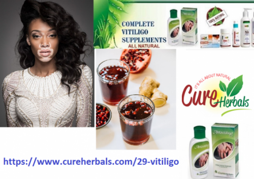 Natural-Treatment-for-Vitiligo-with-Well-Known-Herbal-Vitiligo-Organics.png