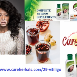 Natural-Treatment-for-Vitiligo-with-Well-Known-Herbal-Vitiligo-Organics