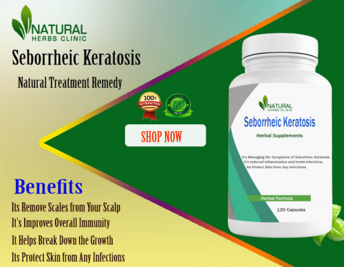 Giving Natural Treatments for Seborrheic Keratosis like apple cider vinegar and tea tree oil a try if you have this skin issue has been shown to aid with the discomfort and appearance of the condition. https://www.herbs-solutions-by-nature.com/blog/natural-treatments-for-seborrheic-keratosis-ideal-option-to-recover-it/