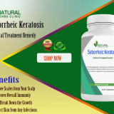 Natural-Treatments-for-Seborrheic-Keratosis-Ideal-Option-to-Recover-it