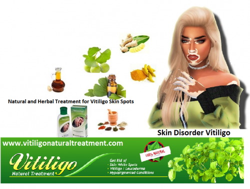 Natural-and-Herbal-Treatment-for-Vitiligo-Skin-Spots.png